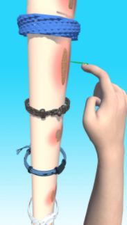 疤痕快跑